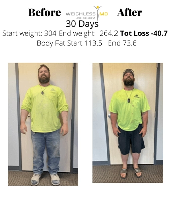 Weight Loss Kenosha WI Before And After