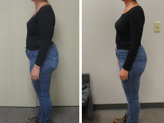 Weight Loss Kenosha WI Before And After