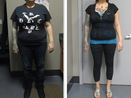 Weight Loss Kenosha WI Before And After