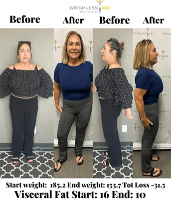 Weight Loss Kenosha WI Before And After