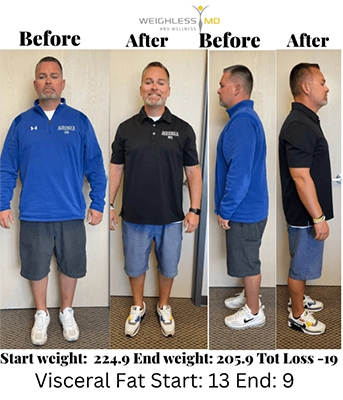 Weight Loss Kenosha WI Before And After