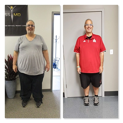 Weight Loss Kenosha WI Before And After