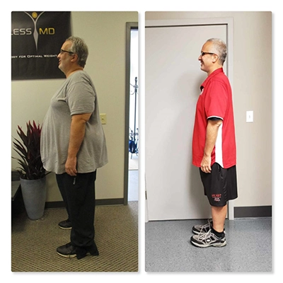 Weight Loss Kenosha WI Before And After