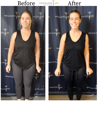 Weight Loss Kenosha WI Before And After