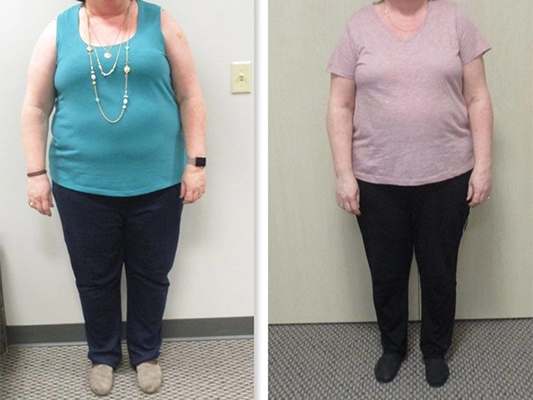 Weight Loss Kenosha WI Before And After