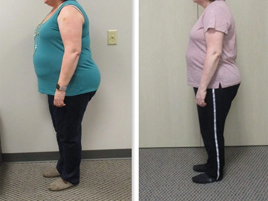 Weight Loss Kenosha WI Before And After