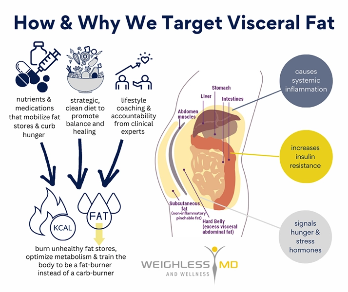 Weight Loss Kenosha WI Visceral Fat Diagram